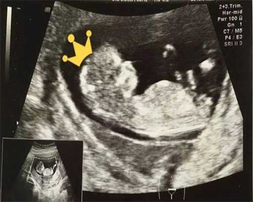 48岁高龄生育的挑战与供卵技术解析：科学实现梦想