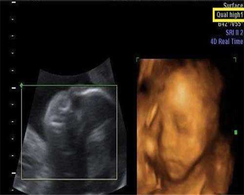 厦门冻胚移植时间如何确定？错过最佳窗口期怎么办？